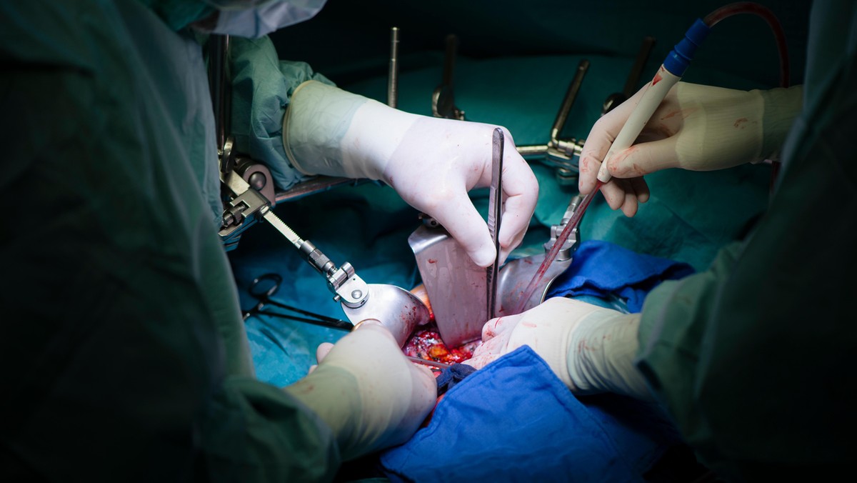 Surgeons transplanting a liver