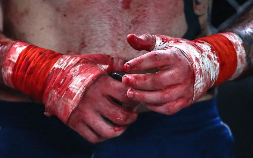 Krwawa walka na gołe pięści w Rosji. Twarze zawodników przypominały miazgę