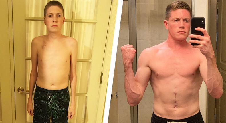 This Man Managed Crohn's Disease and Got Strong