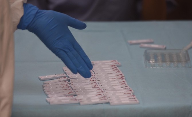 Od ljudi koji su pozitivno testirani na korona virus 8.8 odsto prijavilo je osip na koži kao jedan od simptoma