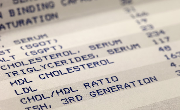 Za wysoki cholesterol daje pewne charakterystyczne objawy