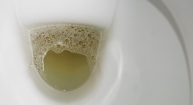 It's essential to pay attention to the characteristics of your urine.