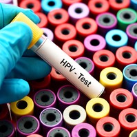 HPV-fertőzés: ezzel az új magyar módszerrel gyógyítanak betegeket