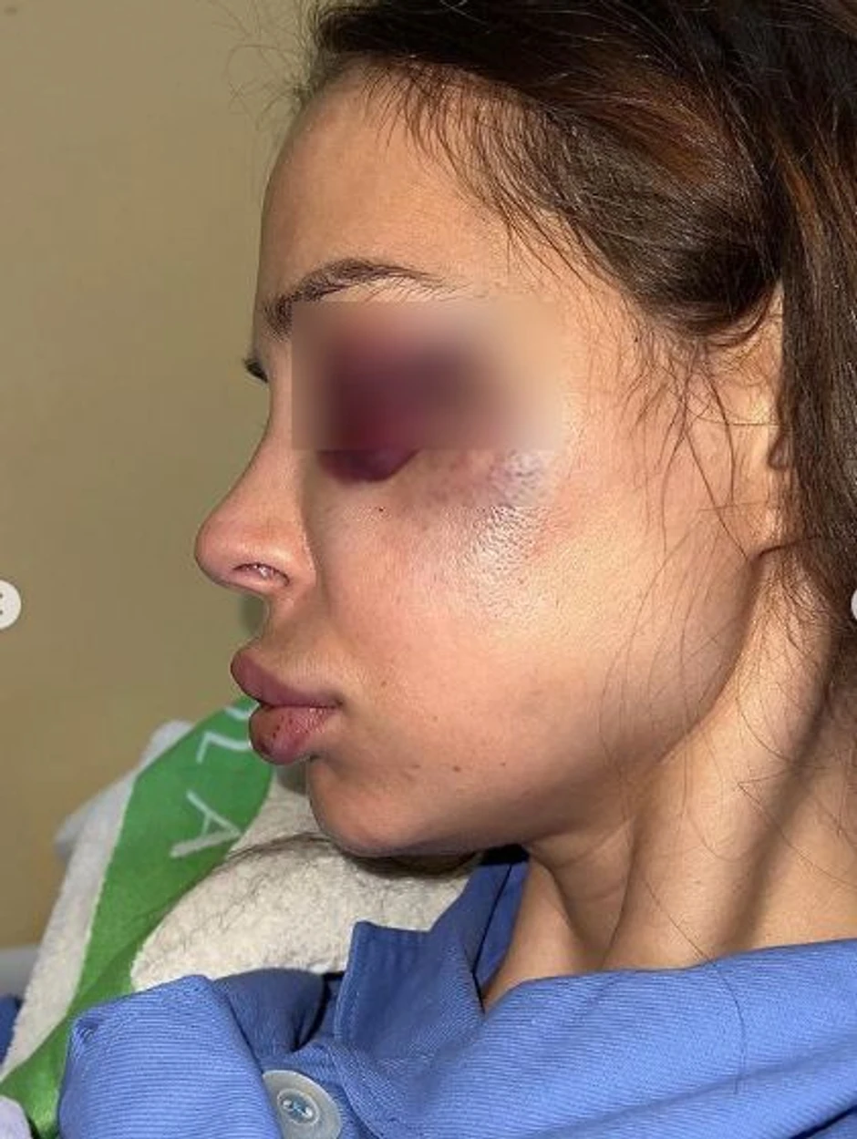 Nataša Šavija pretučena