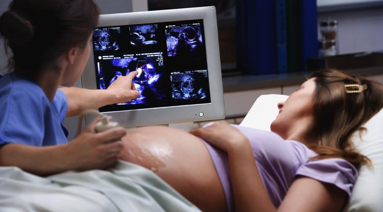 Úgy tudta, hármas ikreket vár, de az ultrahang mást mutatott Fotó: Getty Images