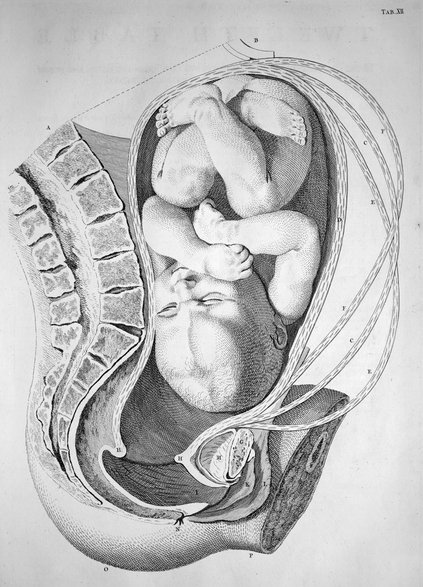 Rycina z książki na temat położnictwa z 1754 roku autorstwa Williama Smellie`a