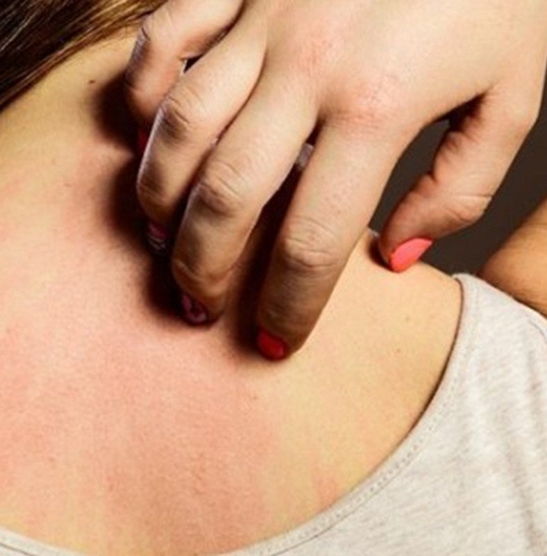 Rák betegség tünetei