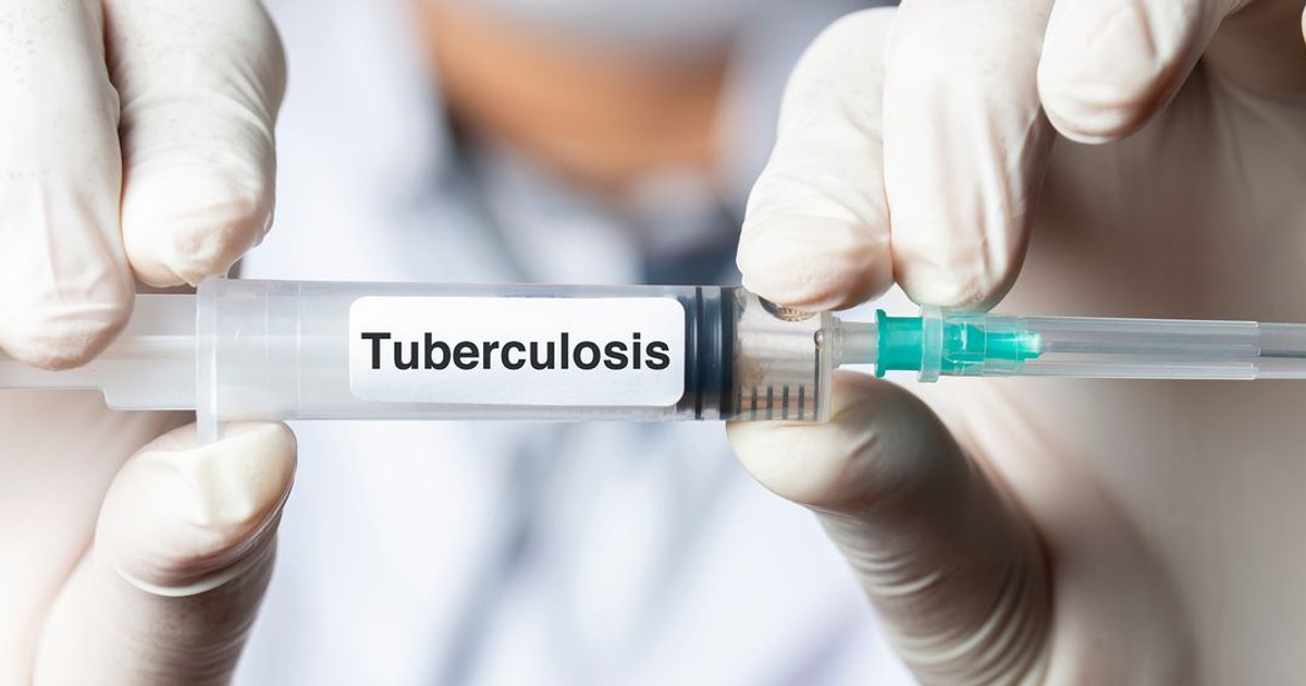 Wellcome, Gates Foundation funds new tuberculosis (TB) vaccine in 100 years advance - Vimarsana News