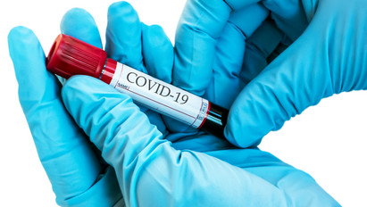 Koronavírus: először emelkedett tizenkétezer fölé az új fertőzöttek száma Oroszországban
