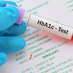 Mit jelent a HbA1c érték a laborleleten?
