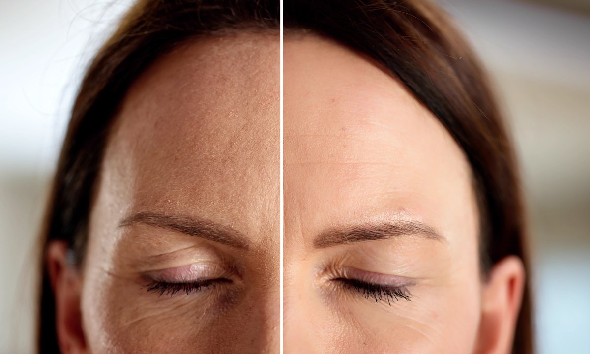 Ten krem to "dźwig" na opadającą powiekę. Unosi, napina i wyraźnie odmładza