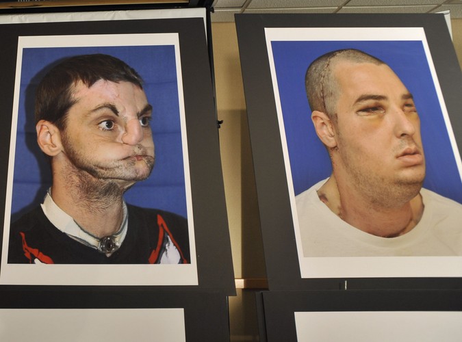 Richard Lee Norris dostał nową twarz