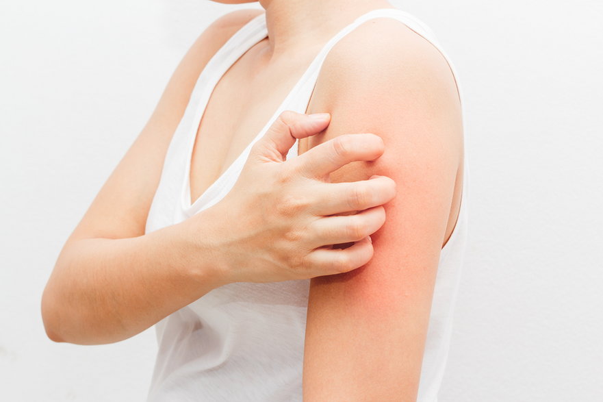 Atopowe zapalenie skóry niestety jest coraz częstszym schorzeniem występującym w społeczeństwie