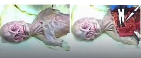 Slike sa navodne autopsije vanzemaljca iz srušenog NLO-a