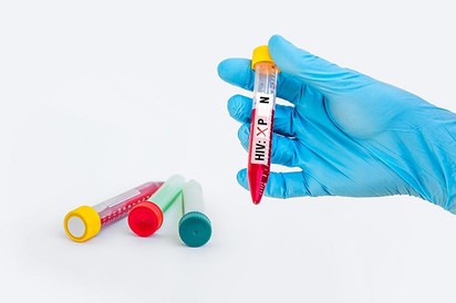 Ismerd meg a HIV-státuszod!