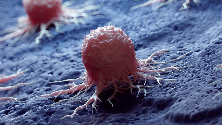 tumor, daganat, oka, tünete, áttét, rák jele