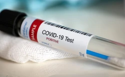 COVID częściej odbierał pracę młodym niż emerytom