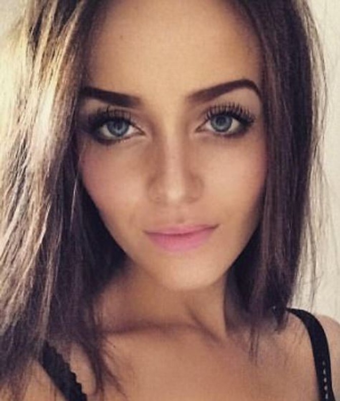Ana je rešila da svoj slučaj podeli sa svetom