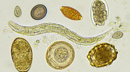 Masz takie dolegliwości? To mogą być pasożyty - sprawdź, jak je wykryć