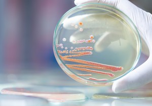 Bakterija Serratia Marcescens