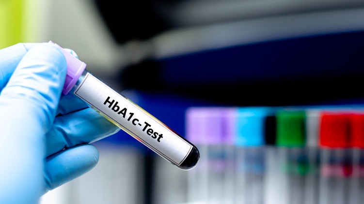 HbA1c cukorbetegség ellenőrzés beállítás