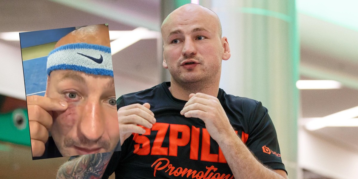 Artur Szpilka pracuje nad formą przed kolejnymi wyzwaniami. 