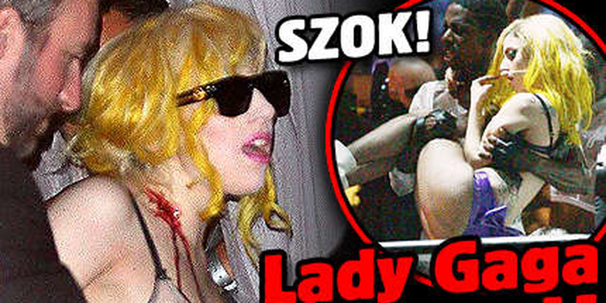 Szok! Lady Gaga krwawi