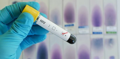 Alarmujące dane o wzroście zakażeń HIV w Polsce. Podwojona liczba nowych zakażeń to efekt pandemii? 2022 roku przyniesie nowy rekord