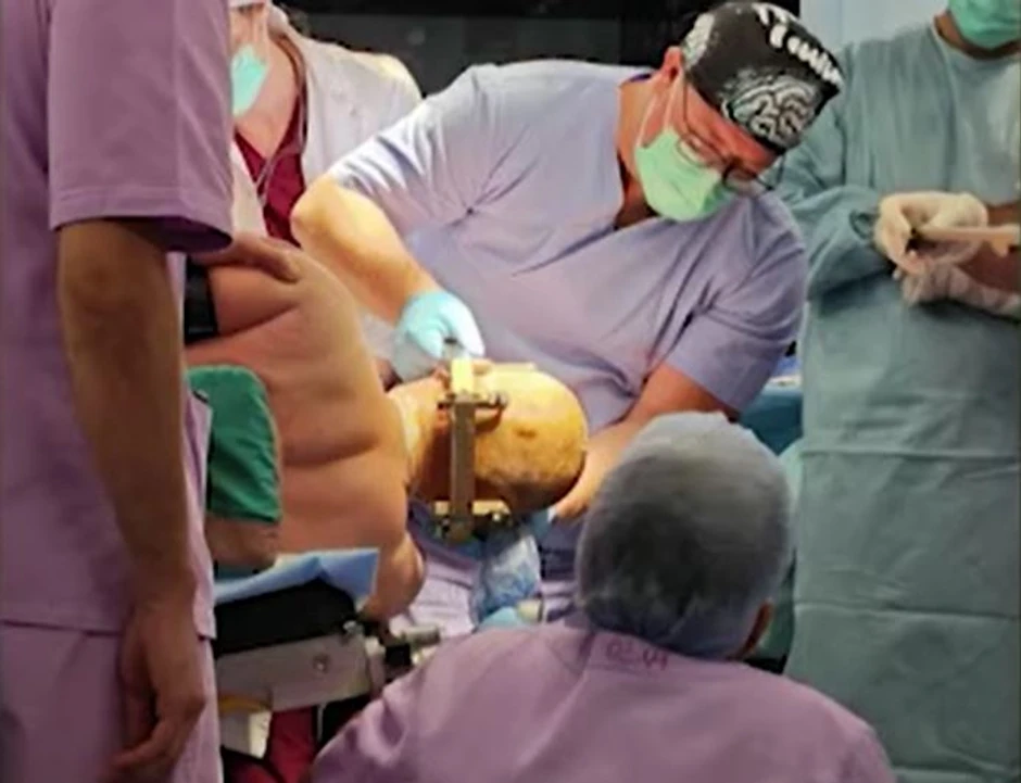 Priprema za proceduru je trajala 5 sati a sama procedura više od 8 sati