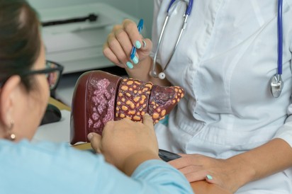 Májkárosodás, májzsugorodás: több betegség végstádiumára is jellemző