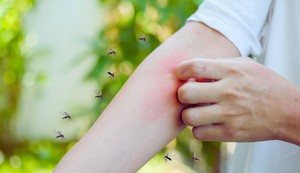 Miris tela je presudan faktor koji određuje koga će komarac ujesti