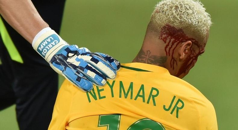 Brazil's Neymar bleeds after being injured in the face during the 2018 World Cup football qualifier against Bolivia in Natal, Brazil, on October 6, 2016