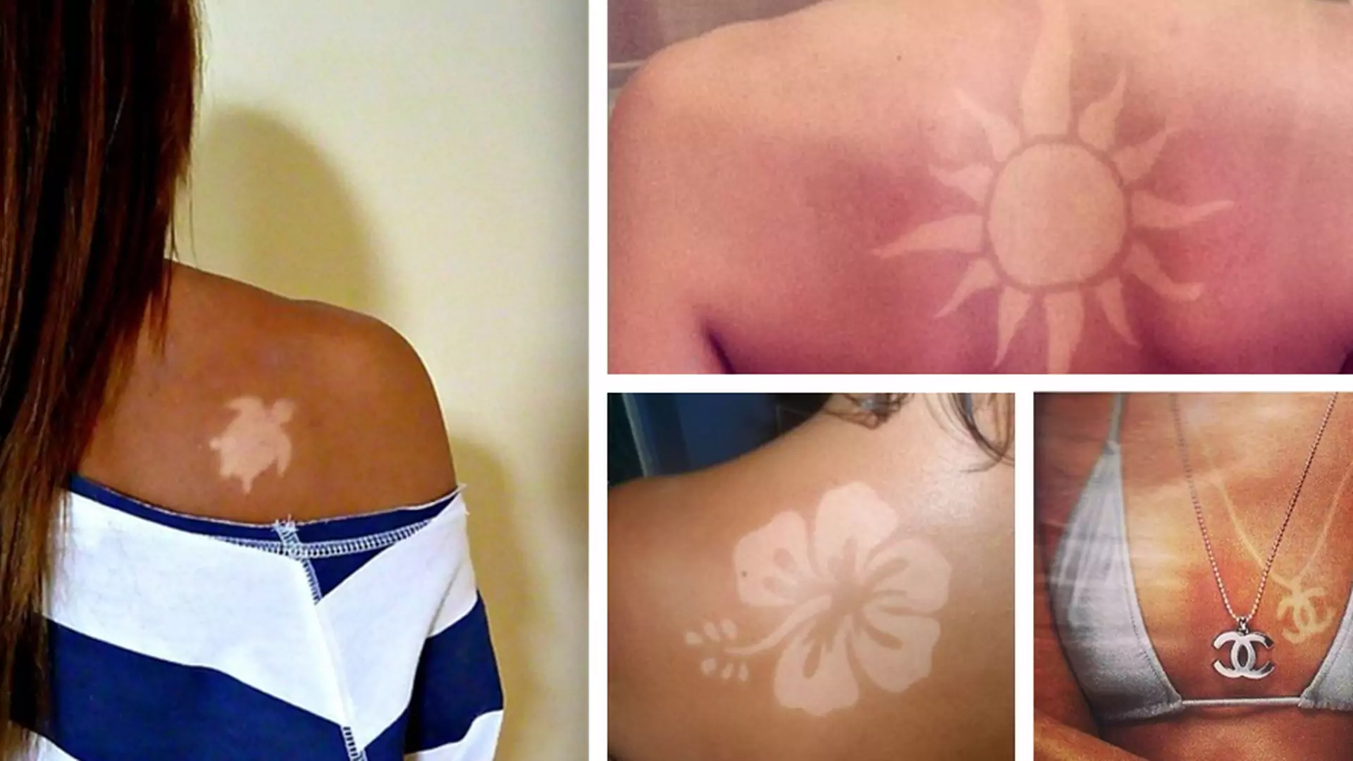 #sunburnart: tatuaże na skórze poparzonej słońcem Niebezpiecznie głupi, letni trend zdobywa internet