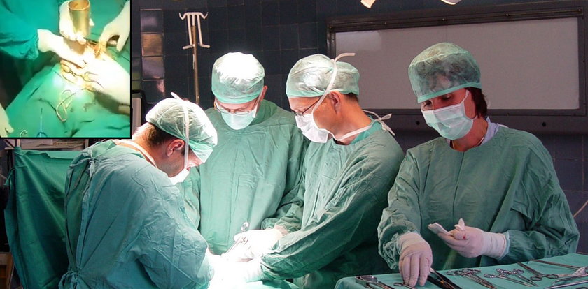 Lekarze usunęli metalowy kubek z żołądka mężczyzny. Niewiarygodne, jak się tam znalazł!