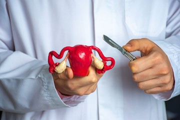 Itt a válasz arra, hogy  vajon zsugorítható-e a mióma
