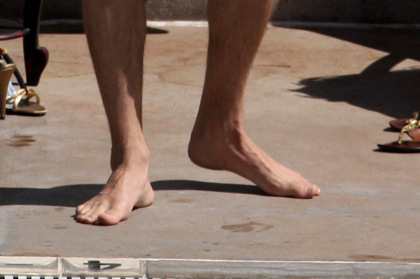 Ashton Kutcher ma zrośnięte palce u stóp