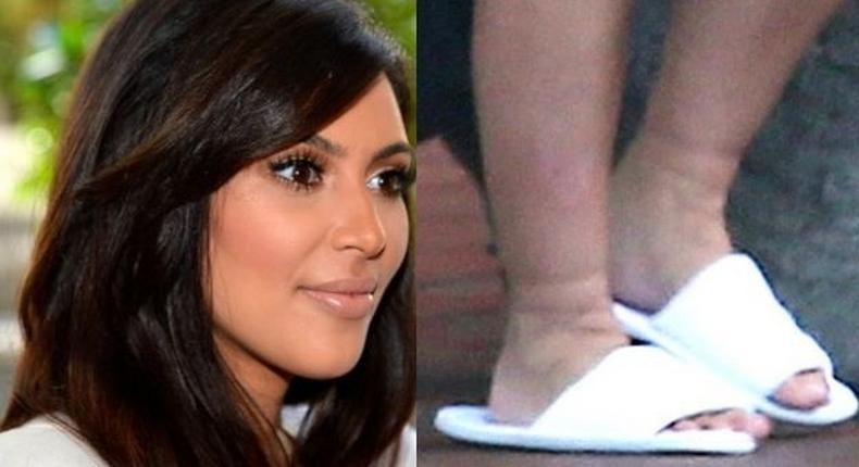 Kim Kardashian suffers swollen feet during 2nd pregnancy