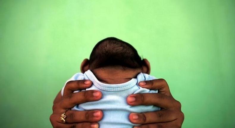 A 4-month-old baby born with microcephaly is held by his mother in front of their house in Olinda, near Recife, Brazil, February 11, 2016. 