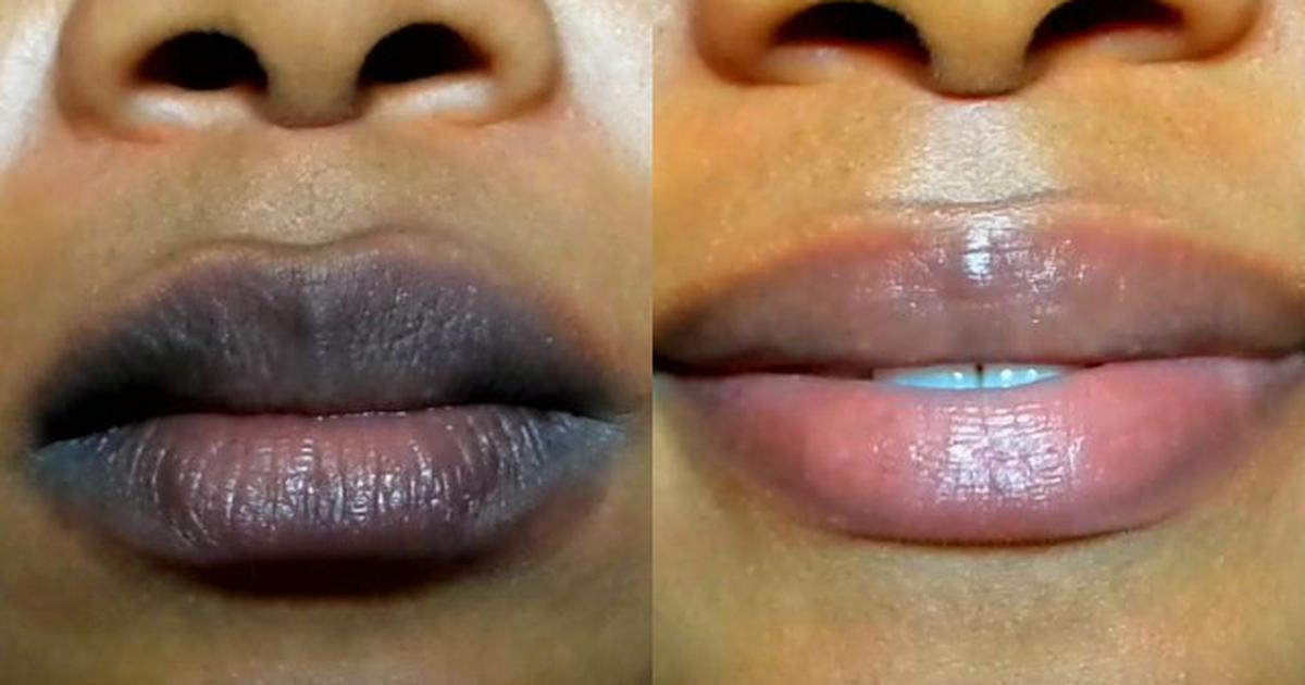 Heres A Simple Method To Lighten Dark Lips Naturally Pulselive Kenya