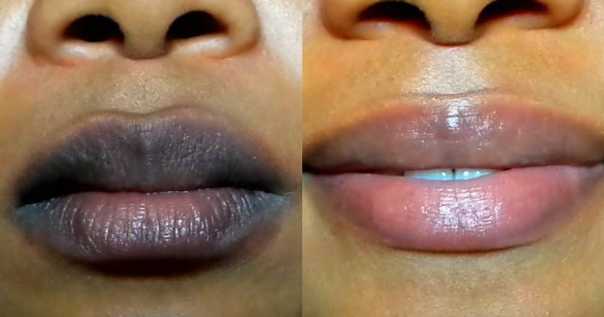 Heres A Simple Method To Lighten Dark Lips Naturally Pulselive Kenya