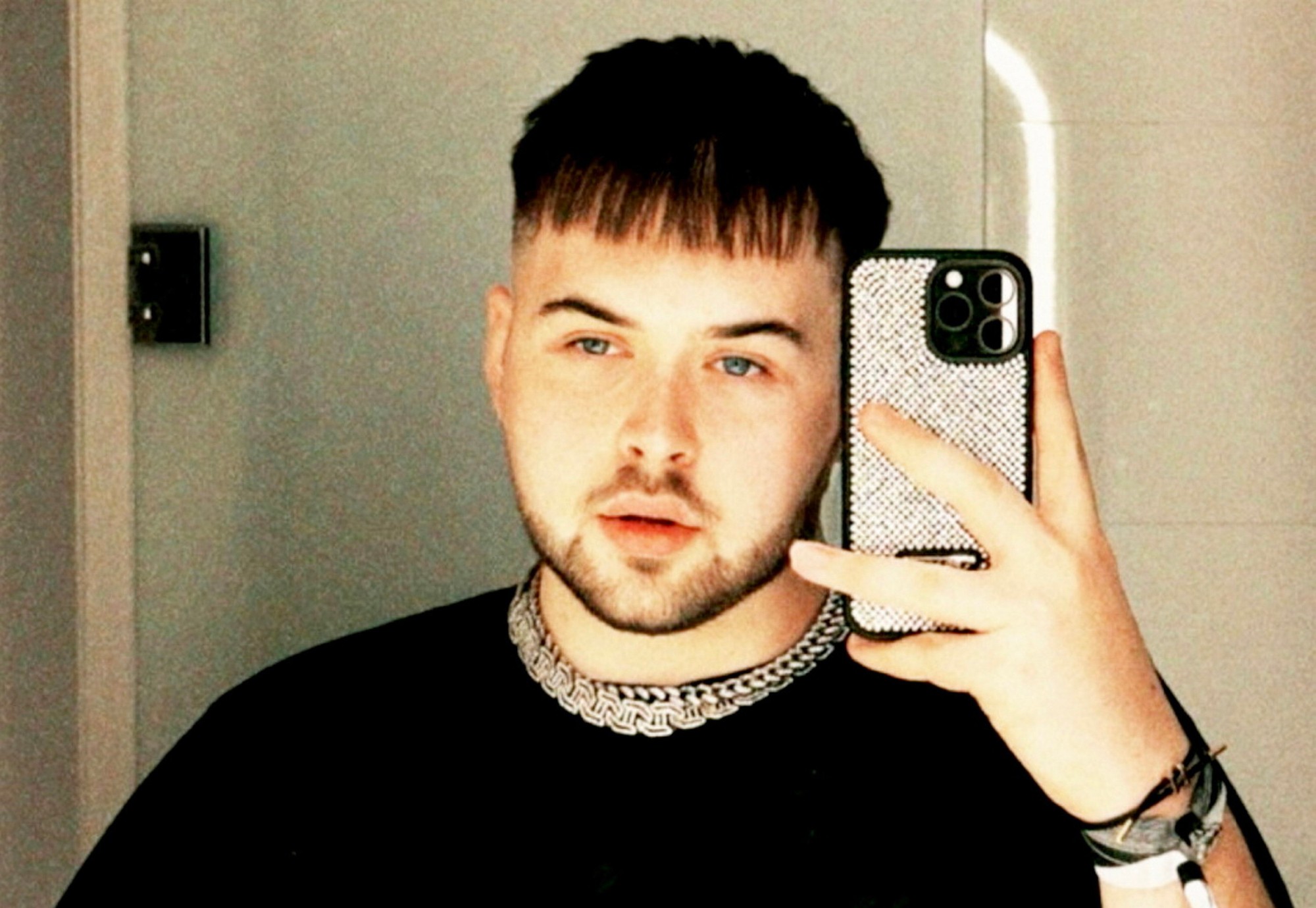 Jak od svojich 16 rokov navštevoval solárium päťkrát týždenne po dobu 18 minút.