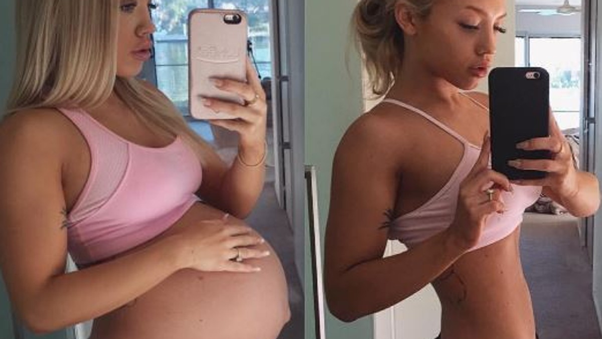 Tammy Hembrow to trenerka fitness z Queensland w Australii, która jest mamą dwójki dzieci. Niedawno opublikowała porównanie zdjęć: na jednym jest w zaawansowanej ciąży, a drugie przedstawia jej brzuch dwa miesiące po porodzie. Kolaż wywołał wiele odmiennych komentarzy internautów.