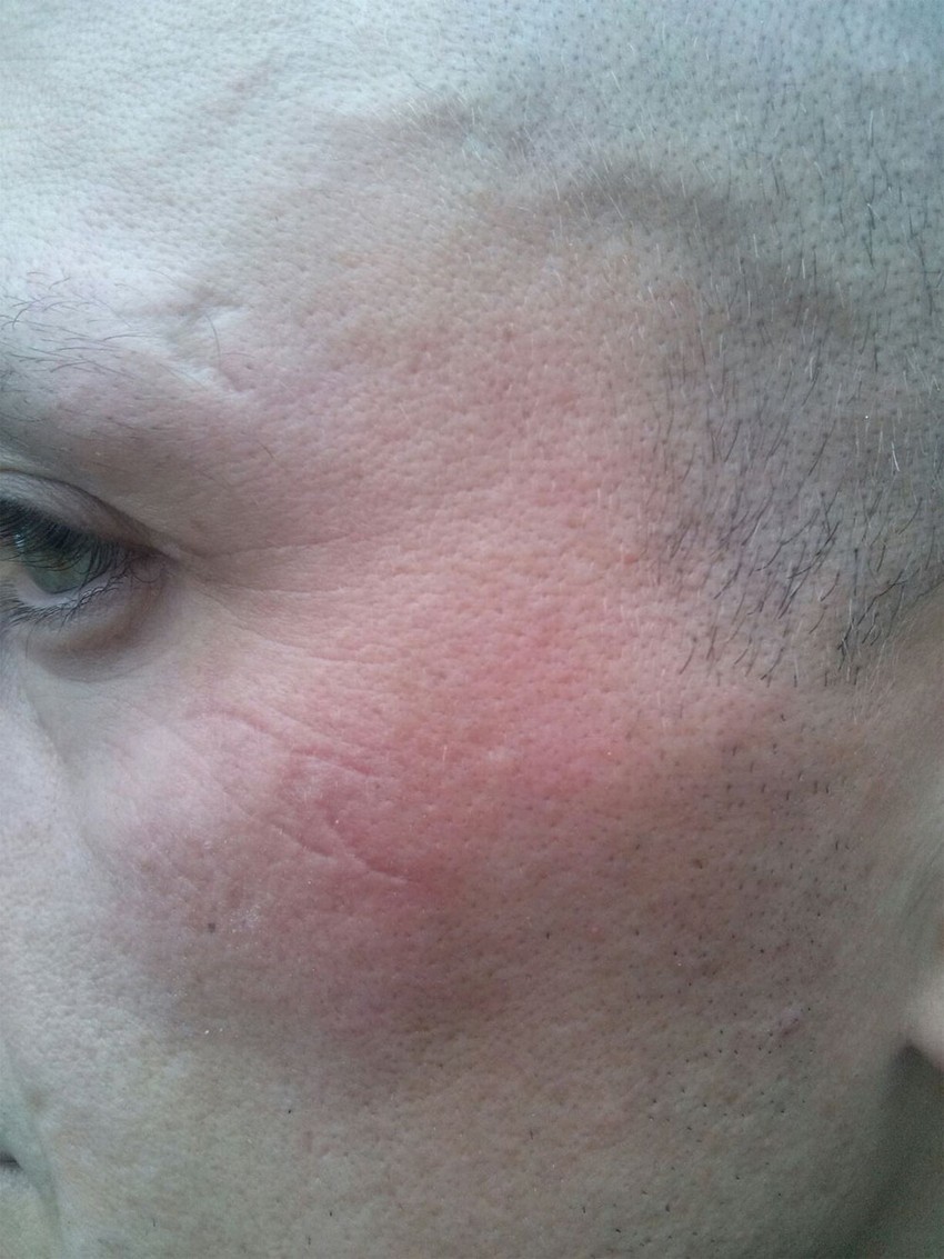 Komunalni policajac A.O. zadobio je povrede lica