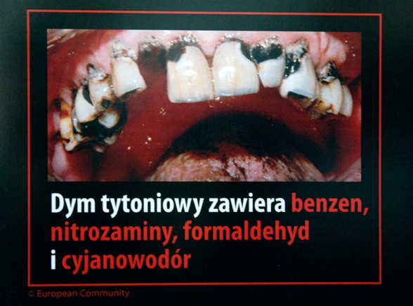 Z okazji Światowego Dnia Bez Tytoniu ministerstwo zdrowia zorganizowało wystawę grafik, jakie w różnych krajach straszą z paczek papierosów