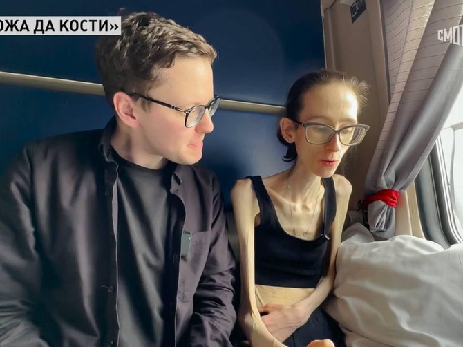 Anastasija sada ne može ni da jede normalno