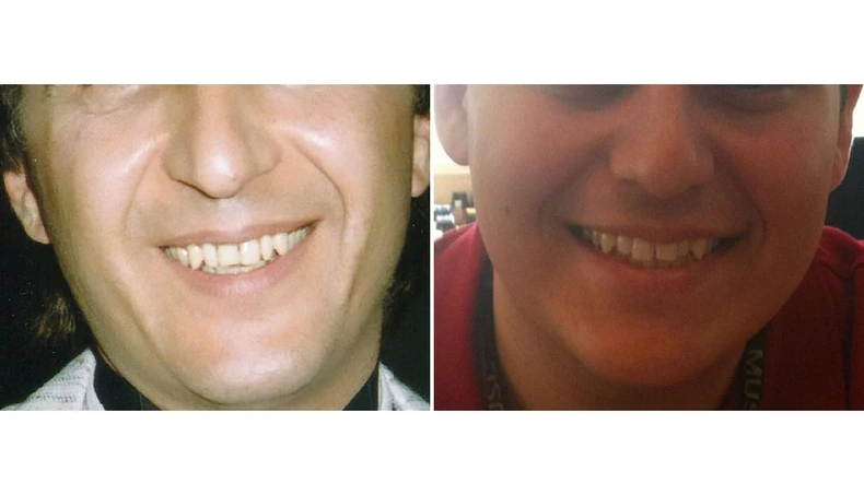 I ranije se govorilo o sličnosti Miroslava i Devina, pevač nije hteo da ide na DNK analizu