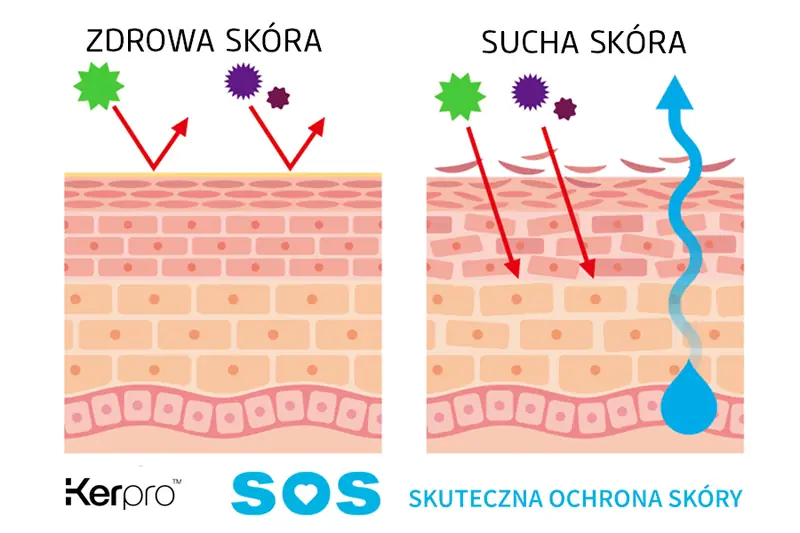 SOS Mycie rąk nie wystarczy