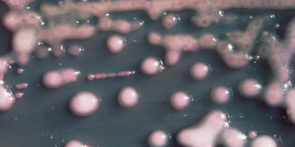 Klebsiella pneumoniae NDM