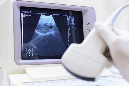 Gyerekvállalás 35 év fölött: miért nehezebb teherbe esni?