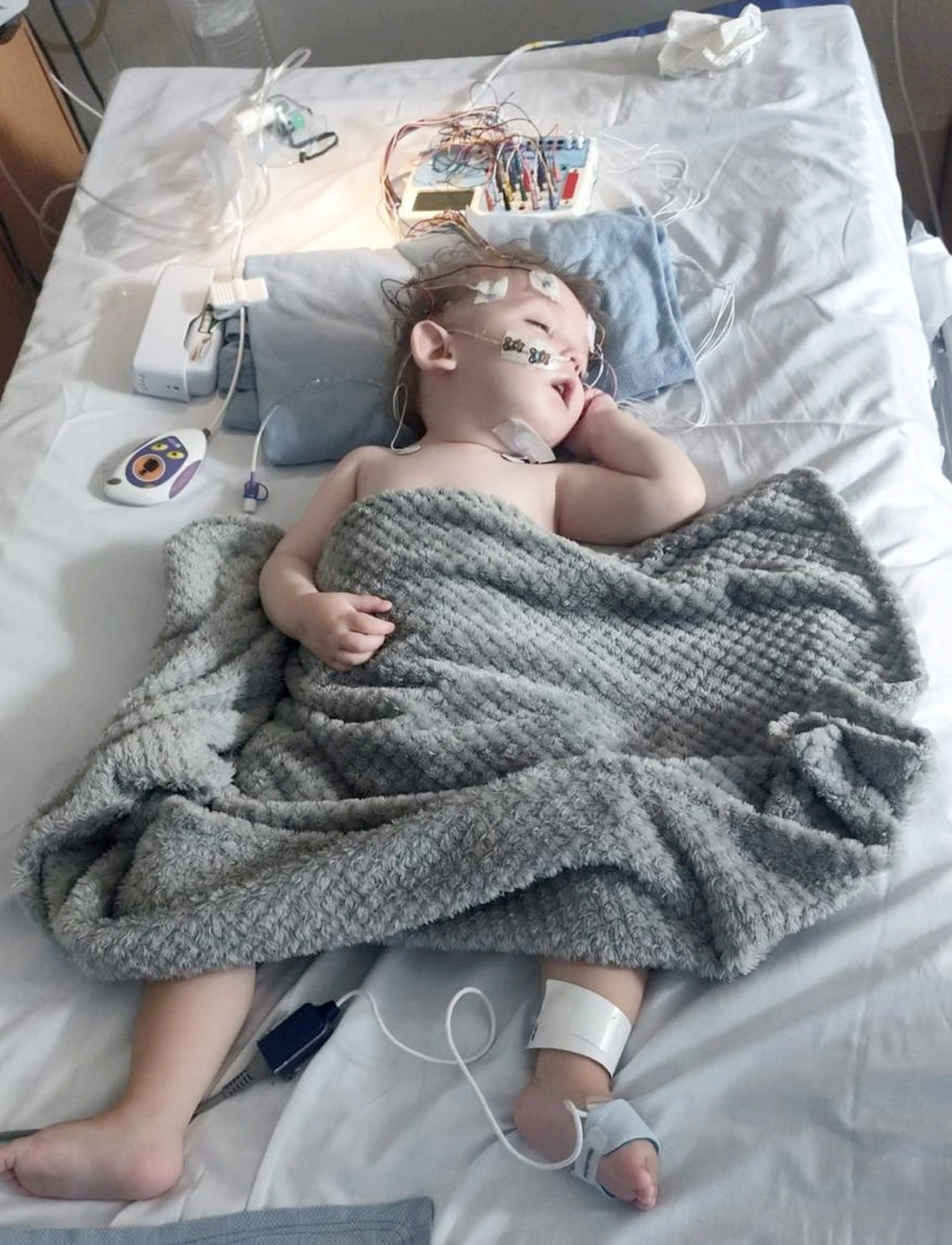 Na Oli-Jayovu chorobu v súčasnosti neexistuje liek.